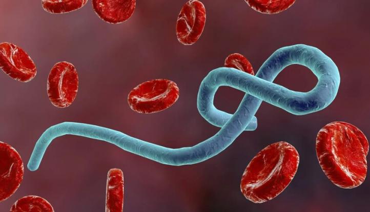أول تحرك برلماني بإجراءات استثنائية لمنع تسلل الإيبولا إلى مصر